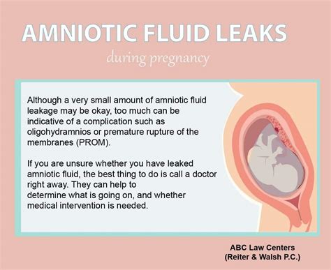 treatment for leaking amniotic fluid|Leaking Amniotic Fluid: Signs, Causes, and。